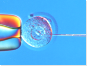 写真：マウス胚へのインジェクション－トランスジェニック(Tg)マウス・ラットの作製-(株)オリエンタルバイオサービス